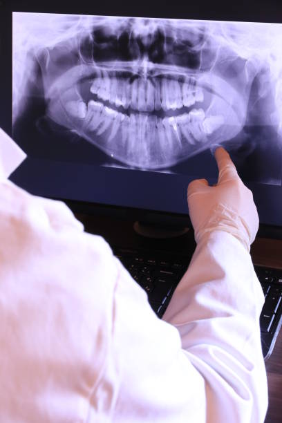 Best Emergency Tooth Extraction in Chester, SC