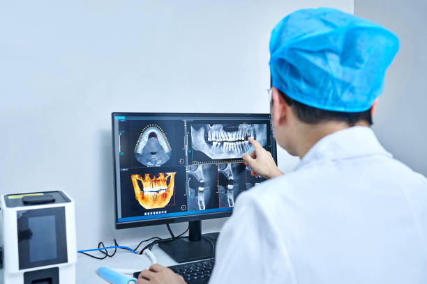 Best Emergency Treatment for Dental Infections or Abscesses in Chester, SC