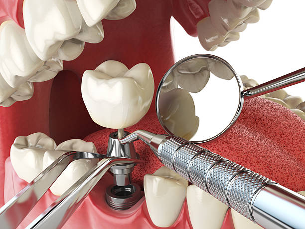 Best Emergency Gum Treatment in Chester, SC